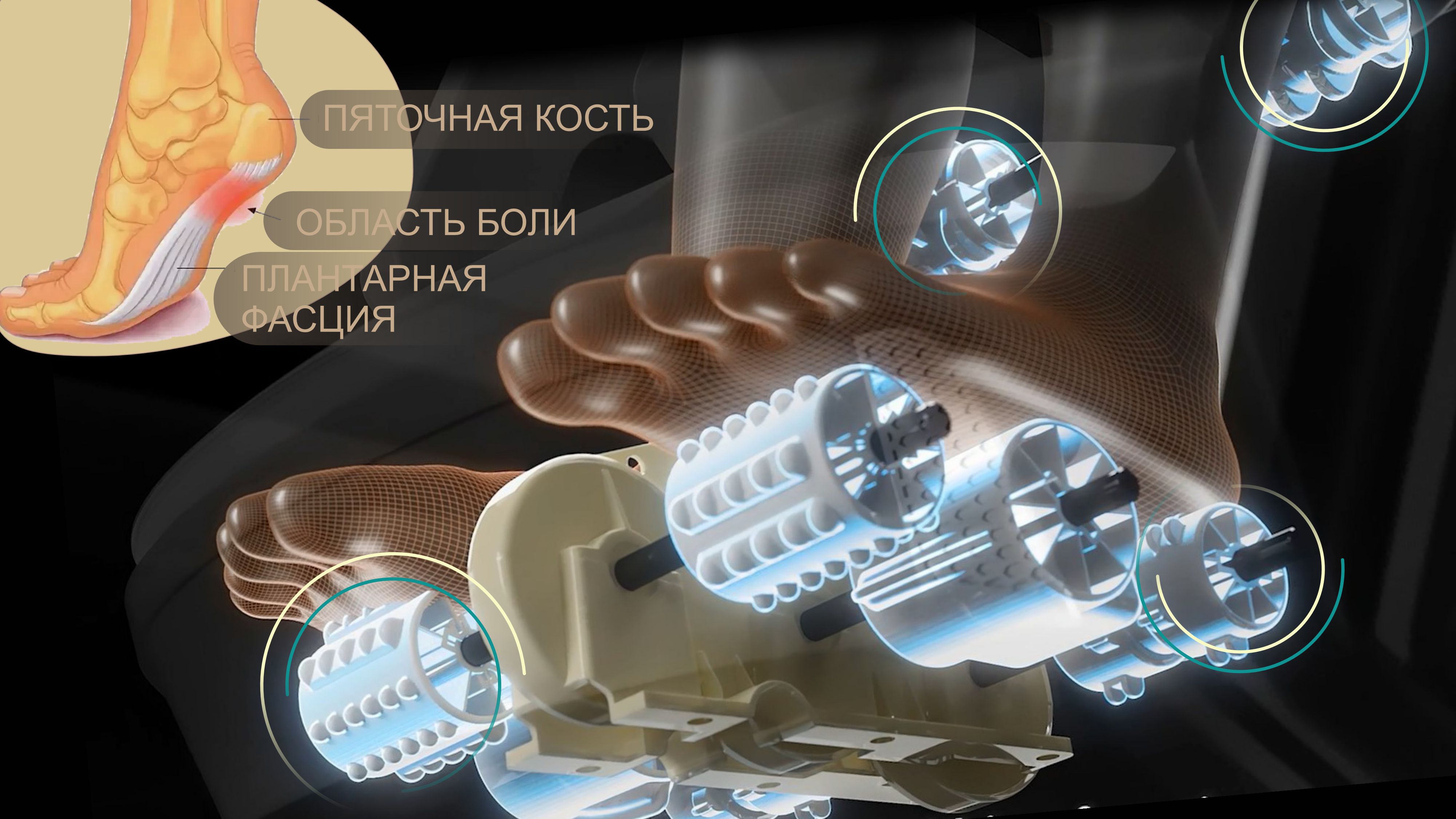 Плантарный массаж стоп - Массажное кресло Bodo Mesa Light Gray Плантарный массаж стоп - Массажное кресло Bodo Mesa Light Gray